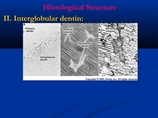 Histological Structure
II. Interglobular dentin:
 