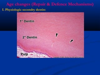 Age changes (Repair & Defence Mechanisms)
I. Physiologic secondry dentin:
 