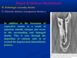 Repair & Defence Mechanisms
II. Pathologic secondry dentin:
C. Sclerotic dentin ( transparent dentin ):
In addition to the formation of
reparative dentin as a result of
injurious stimuli, changes also occur
in the surrounding and damaged
dentin. This is seen through the
deposition of calcium salts in or
around the degenerated odontoblastic
process.
 