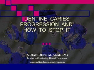 DENTINE CARIES
PROGRESSION AND
 HOW TO STOP IT



 INDIAN DENTAL ACADEMY
  Leader in Continuing Dental Education
    www.indiandentalacademy.com
 