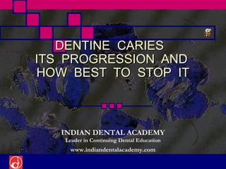 DENTINE CARIES
ITS PROGRESSION AND
HOW BEST TO STOP IT



   INDIAN DENTAL ACADEMY
   Leader in Continuing Dental Education
     www.indiandentalacademy.com
 