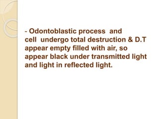 - Odontoblastic process and 
cell undergo total destruction & D.T 
appear empty filled with air, so 
appear black under transmitted light 
and light in reflected light. 
 