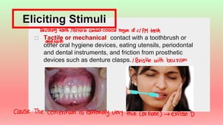 Stimulus Tooth Comprehensive Prevention and Management of Dentin Hypersensitivity in ...