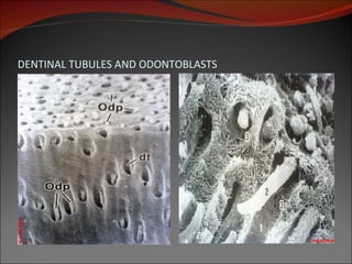 DENTINAL TUBULES AND ODONTOBLASTS 