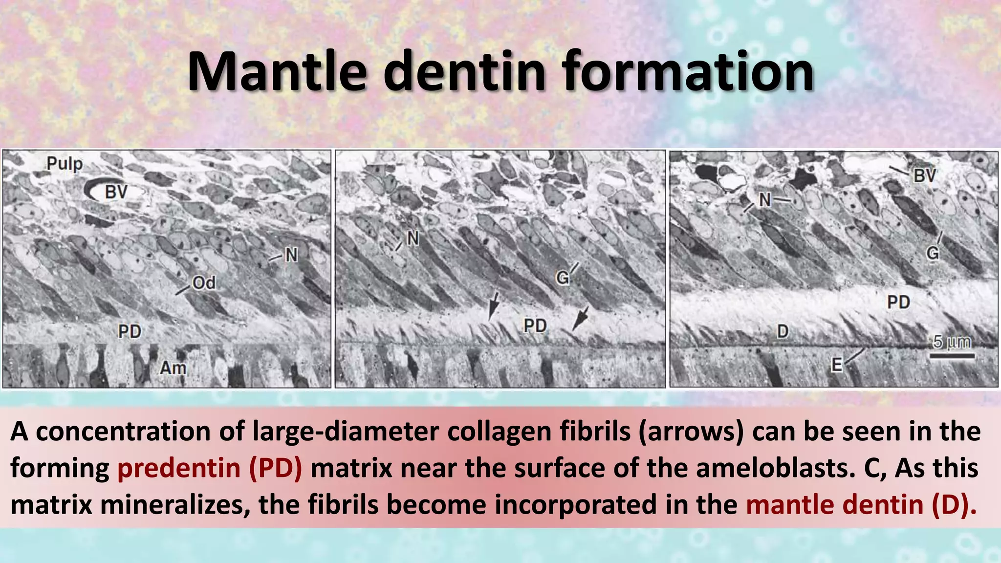 Mantle dentin formation
A concentration of large-diameter collagen fibrils (arrows) can be seen in the
forming predentin (PD) matrix near the surface of the ameloblasts. C, As this
matrix mineralizes, the fibrils become incorporated in the mantle dentin (D).
 
