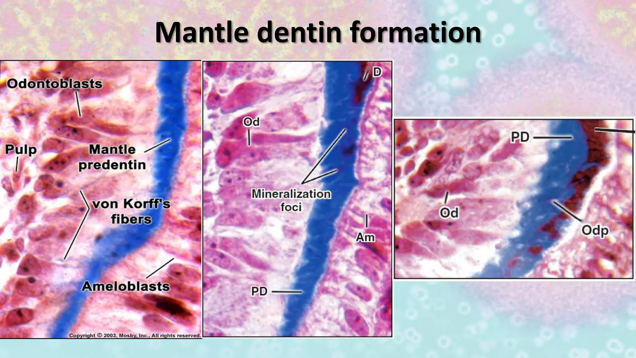 Mantle dentin formation
 
