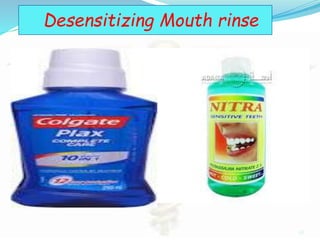 Dentinogenesis Dentin Hypersensitivity