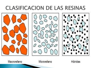 Clasificación de las resinas
compuestas de Lutz y
Phillips. (1983)
 