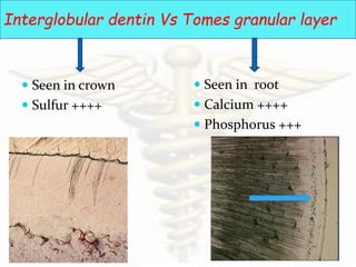 DENTIN (The facts and mysteries) | PPTX