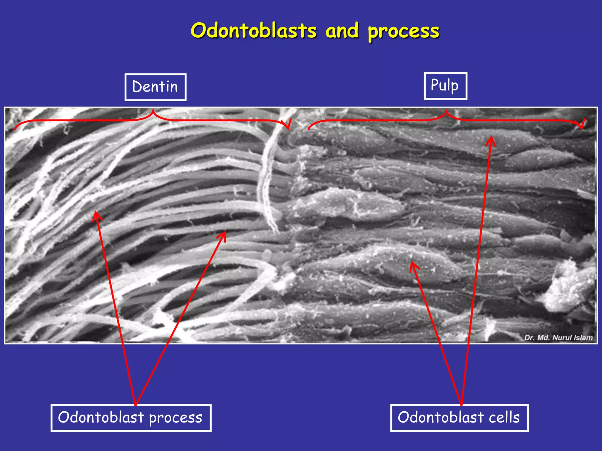 Odontoblasts and process

         Dentin                          Pulp




Odontoblast process                  Odontoblast cells
 