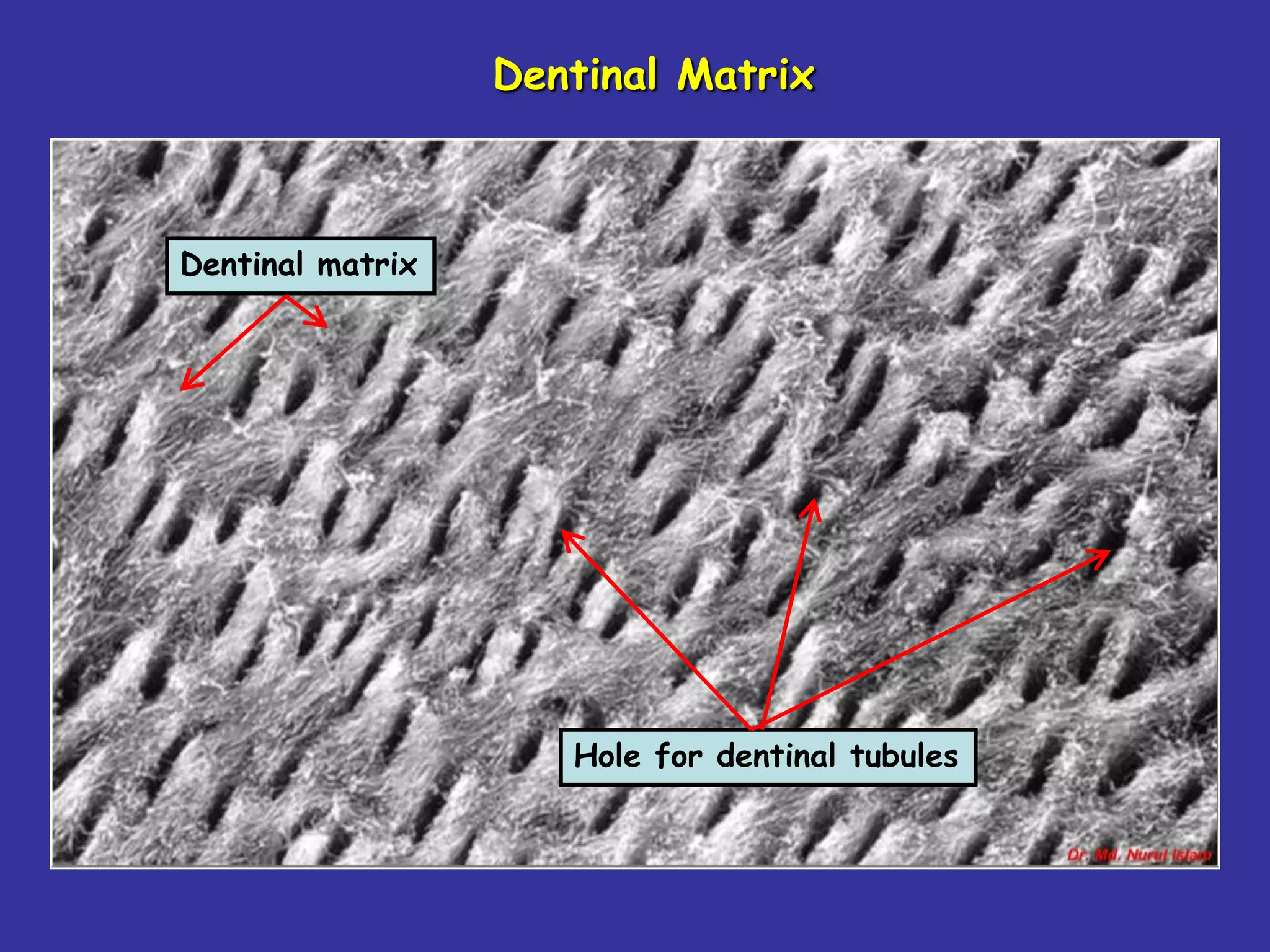 Dentinal Matrix



Dentinal matrix




                     Hole for dentinal tubules
 