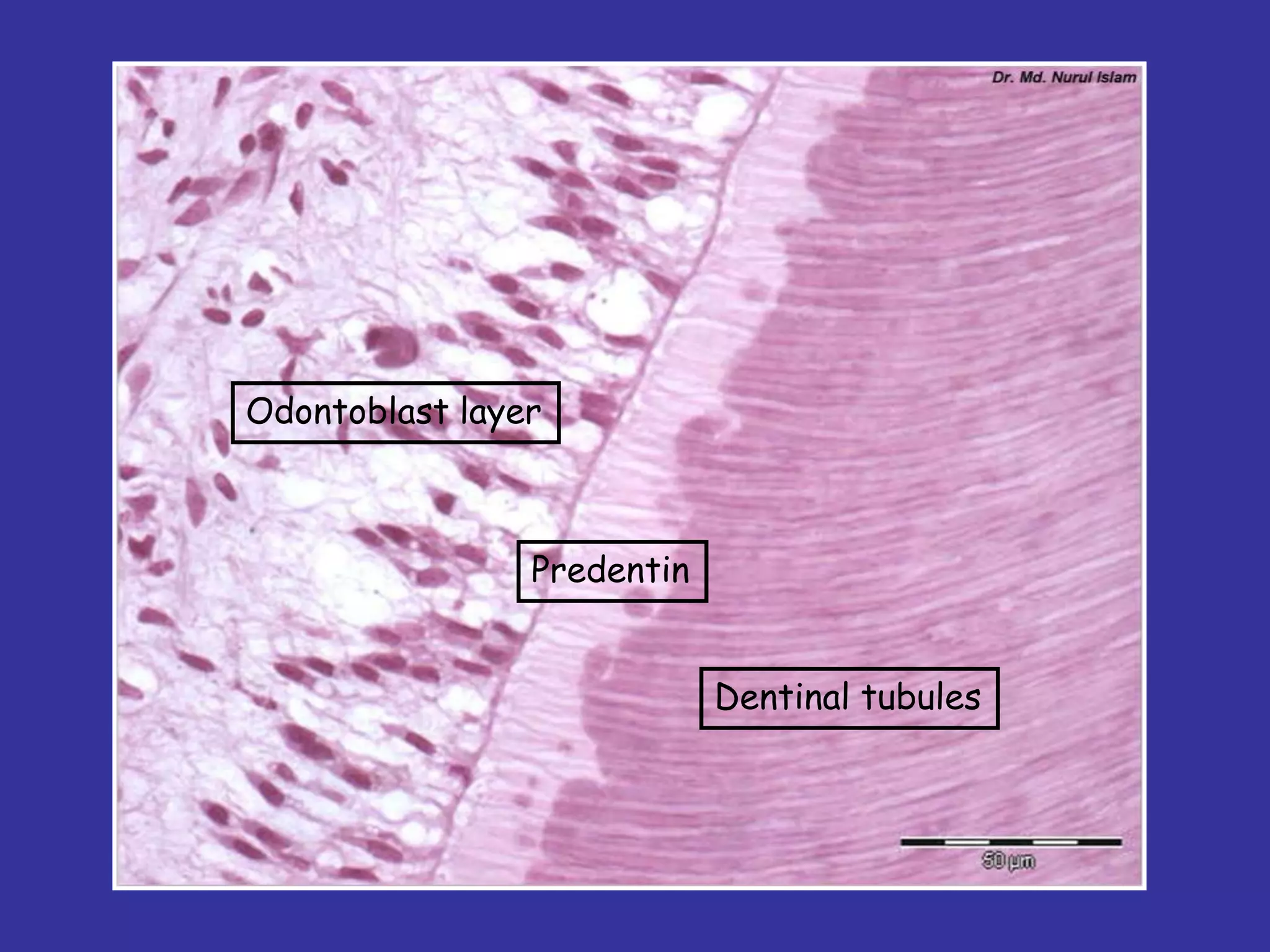 Odontoblast layer



                Predentin


                            Dentinal tubules
 