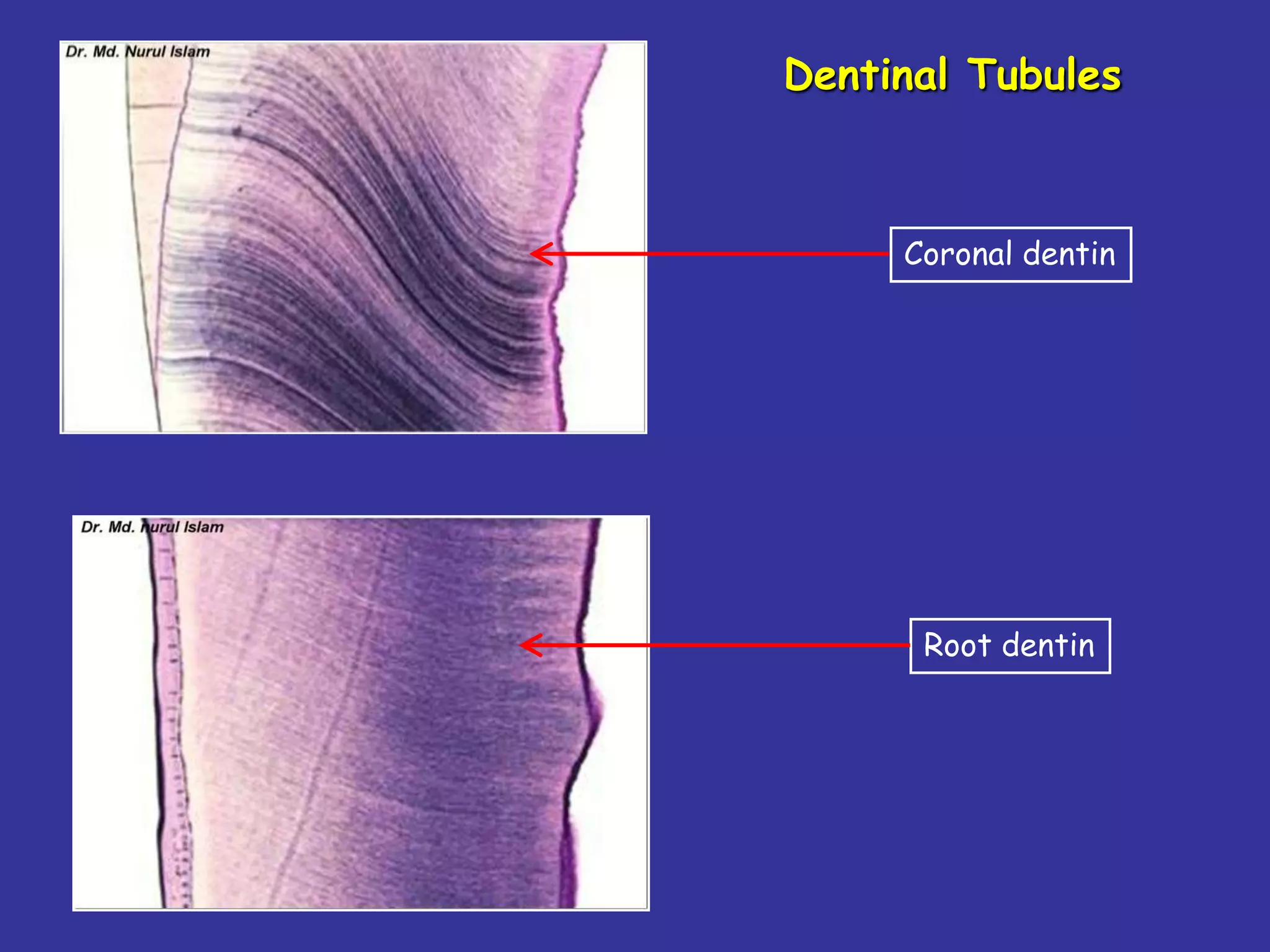 Dentinal Tubules



     Coronal dentin




      Root dentin
 
