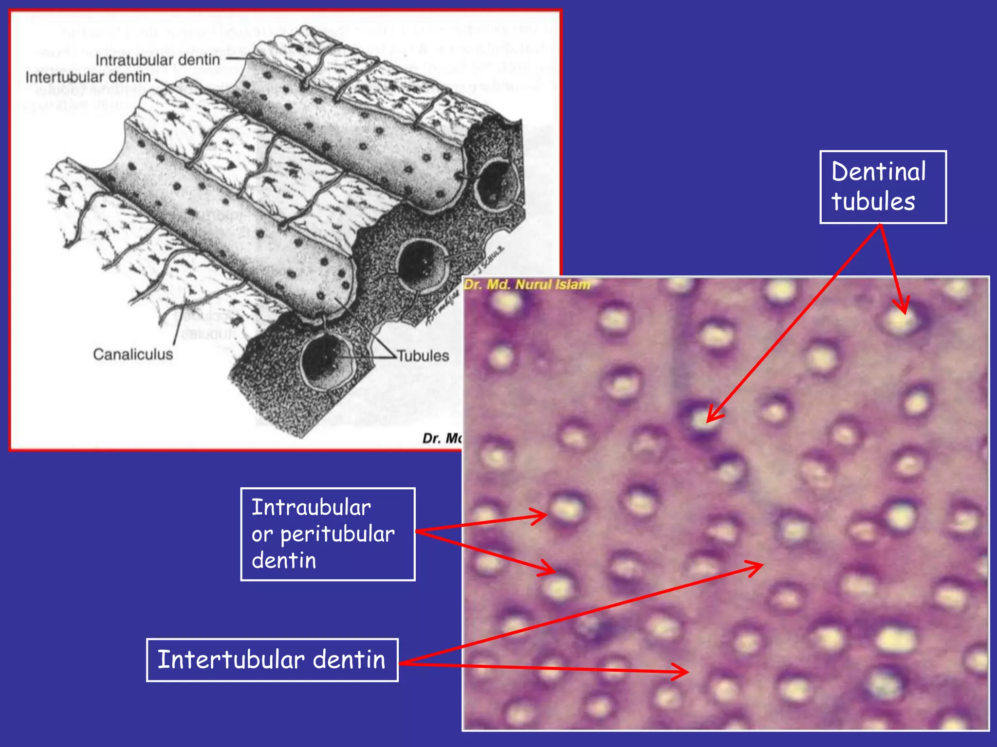 Dentinal
                        tubules




       Intraubular
       or peritubular
       dentin



Intertubular dentin
 