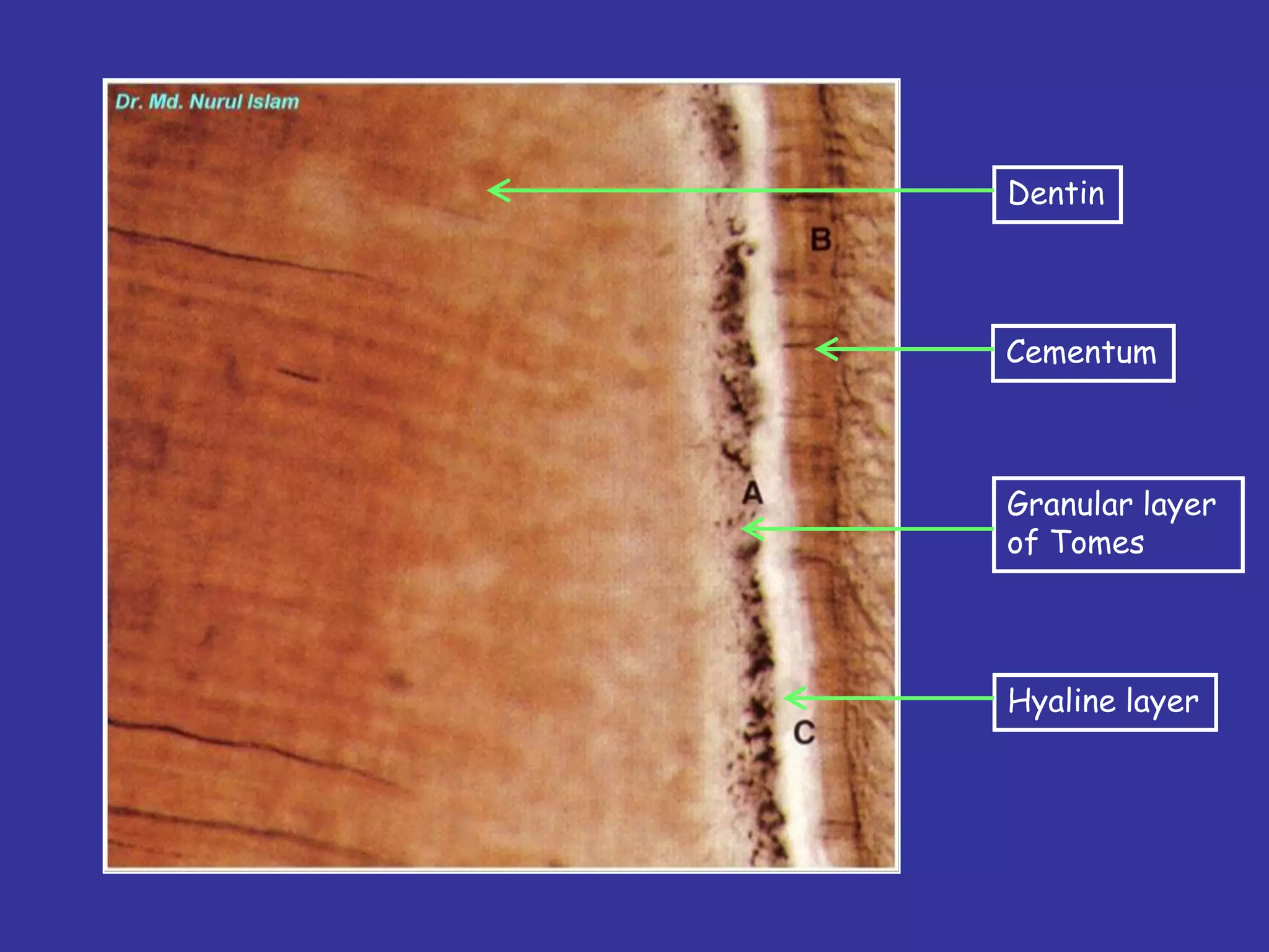 Dentin




Cementum



Granular layer
of Tomes




Hyaline layer
 