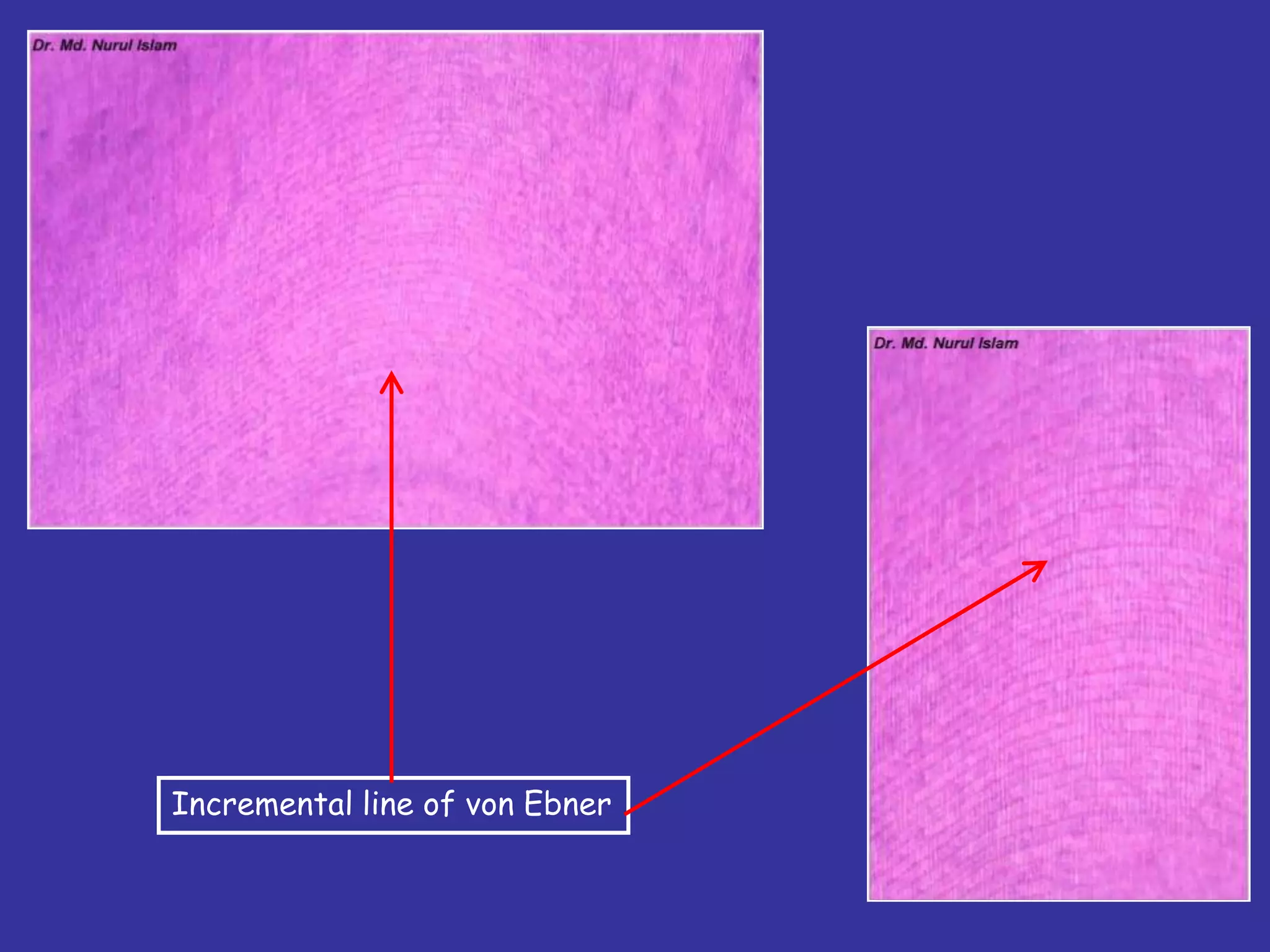 Incremental line of von Ebner
 