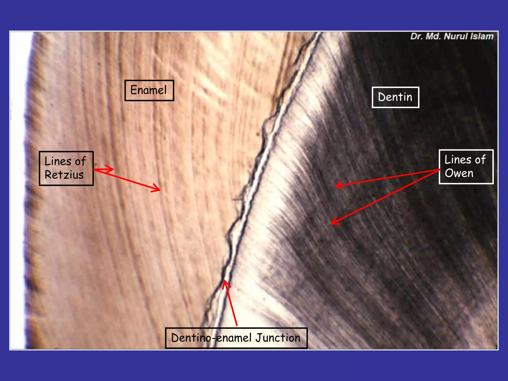 Enamel
                                              Dentin




Lines of                                               Lines of
Retzius                                                Owen




                    Dentino-enamel Junction
 