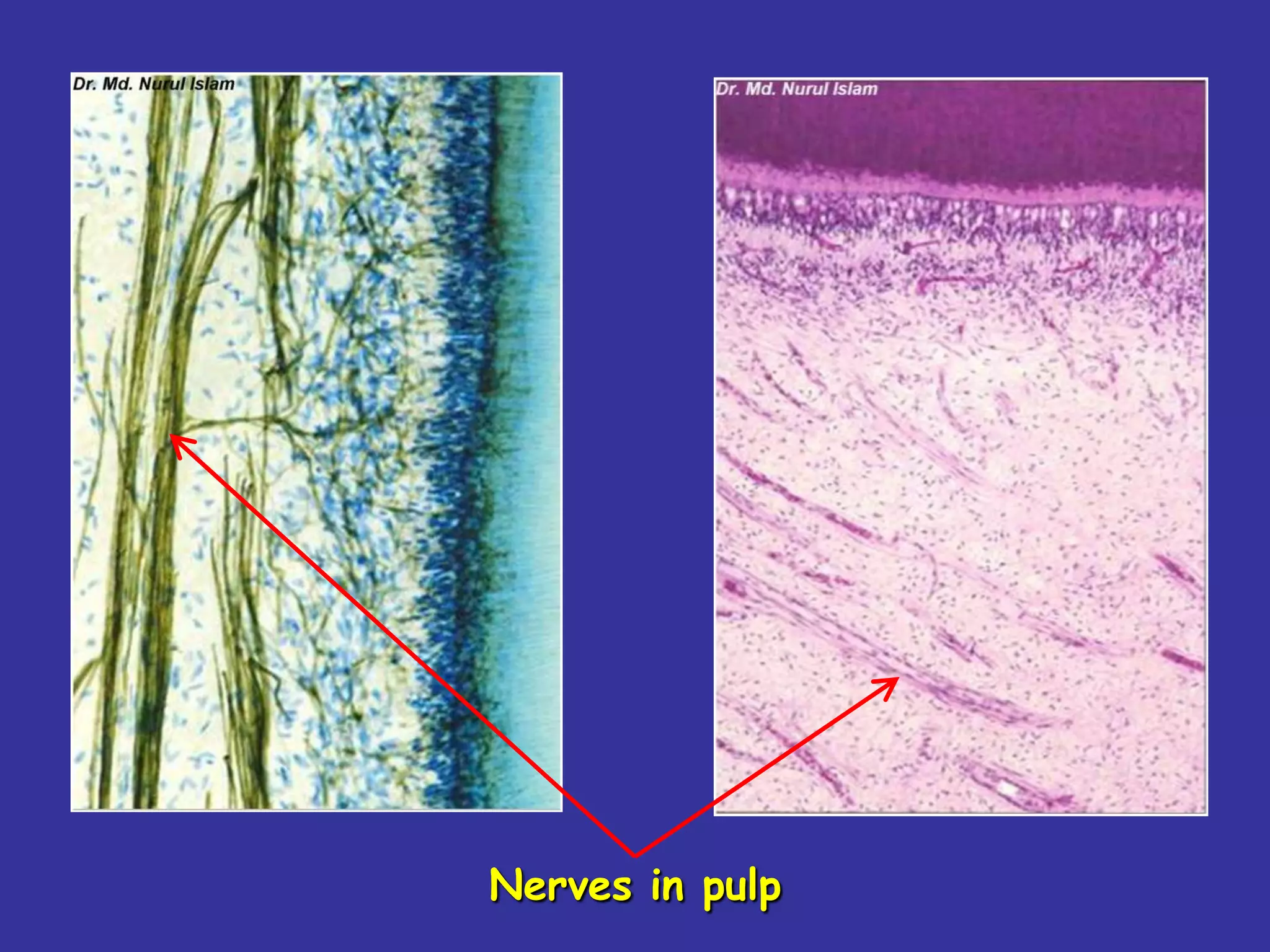 Nerves in pulp
 