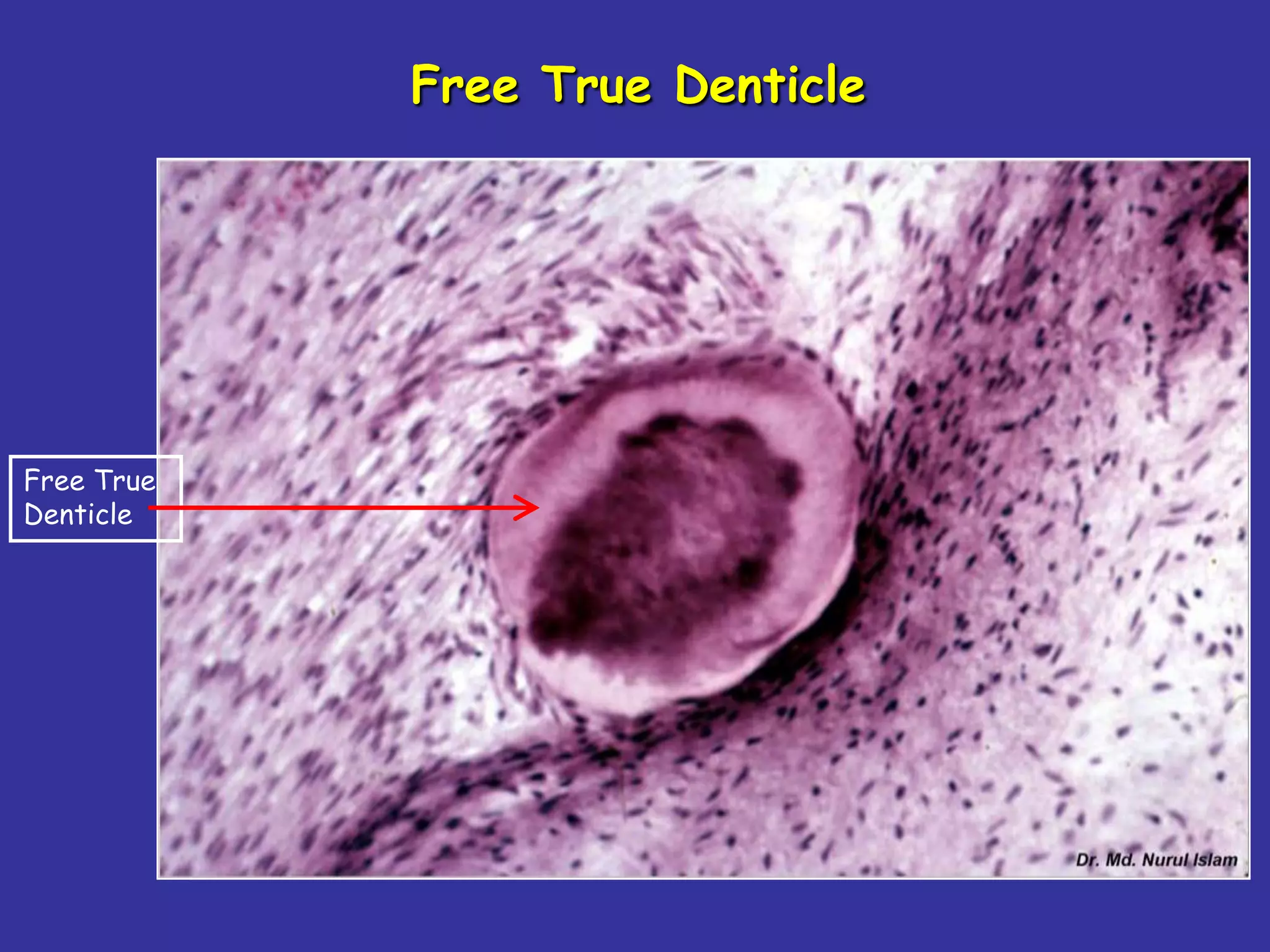 Free True Denticle




Free True
Denticle
 