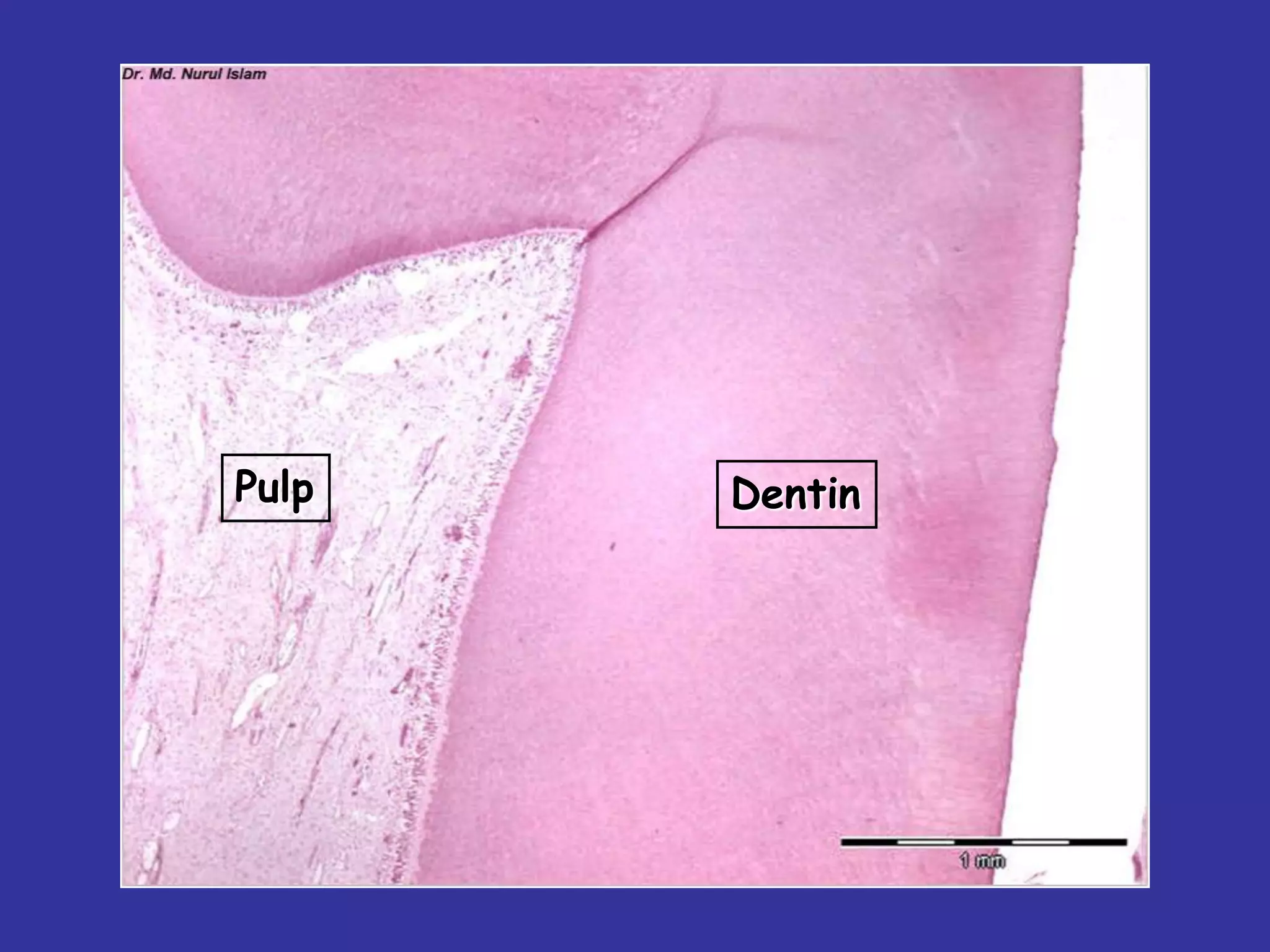Pulp   Dentin
 