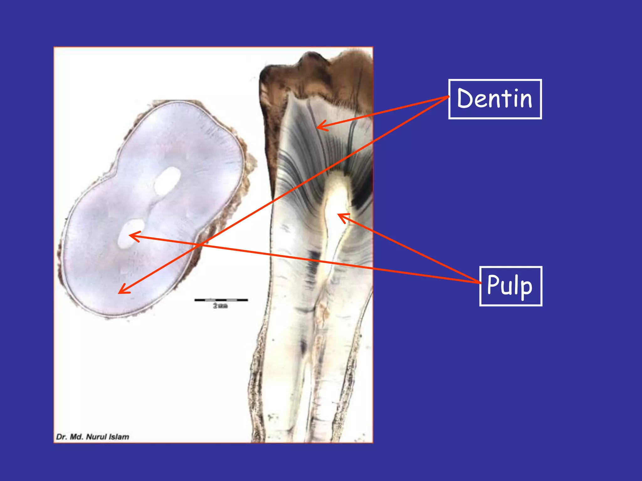 Dentin




  Pulp
 