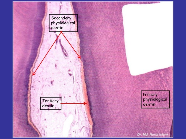 Dentin pulp complex