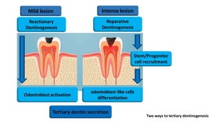 Dentin regeneration based on tooth tissue engineering: A review | PPTX