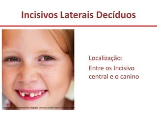 Incisivos Laterais Decíduos



                                                                       Localização:
                                                                       Entre os Incisivo
                                                                       central e o canino



http://clinicaodontomania.blogspot.com/2010/09/o-que-e-fluorose.html
 