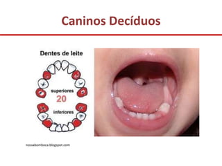 Caninos Decíduos




nossabomboca.blogspot.com
 