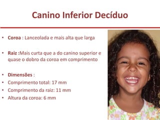 Canino Inferior Decíduo

• Coroa : Lanceolada e mais alta que larga

• Raiz :Mais curta que a do canino superior e
  quase o dobro da coroa em comprimento

•   Dimensões :
•   Comprimento total: 17 mm
•   Comprimento da raiz: 11 mm
•   Altura da coroa: 6 mm
 