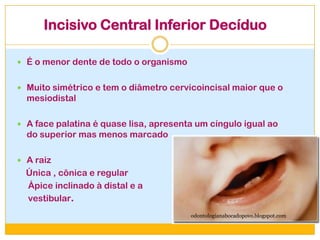 Incisivo Central Inferior Decíduo
 É o menor dente de todo o organismo
 Muito simétrico e tem o diâmetro cervicoincisal maior que o
mesiodistal
 A face palatina é quase lisa, apresenta um cíngulo igual ao
do superior mas menos marcado
 A raiz
Única , cônica e regular
Ápice inclinado à distal e a
vestibular.
odontologianabocadopovo.blogspot.com
 