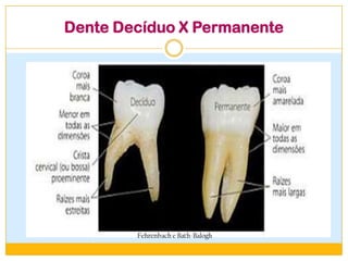 Dente Decíduo X Permanente
 