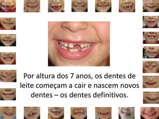 Por altura dos 7 anos, os dentes de
leite começam a cair e nascem novos
dentes – os dentes definitivos.