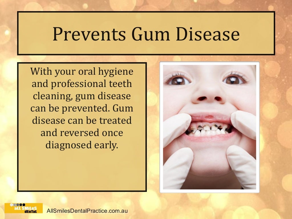 Dentist Geelong Tips The Advantages of Professional Teeth Cleaning