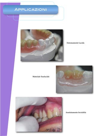 Applicazioni




                              Estremamente Lucida




      Materiale Traslucido




                             Assolutamente Invisibile
 