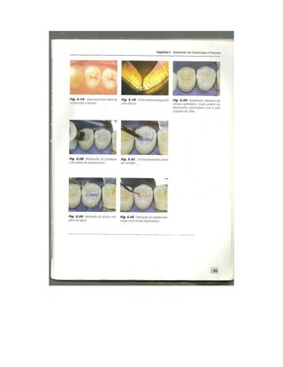 Dentistica 2