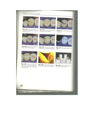 Dentistica 2