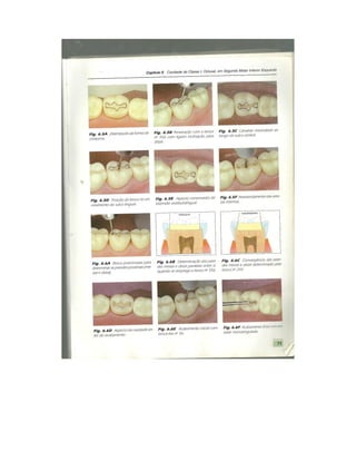 Dentistica 2