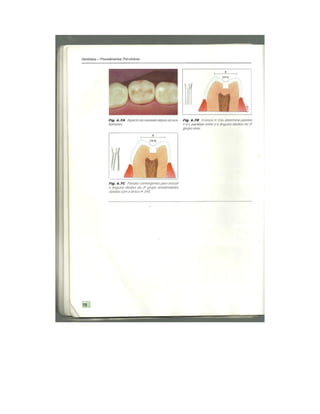 Dentistica 2