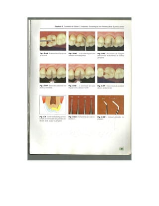 Dentistica 2