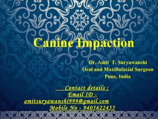 Canine Impaction 
Dr. Amit T. Suryawanshi 
Oral and Maxillofacial Surgeon 
Pune, India 
Contact details : 
Email ID - 
amitsuryawanshi999@gmail.com 
Mobile No - 9405622455 
 