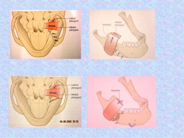 Treatment of mandibular fractures by means of compression osteosynthesis