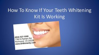 How To Know If Your Teeth Whitening
Kit Is Working

 