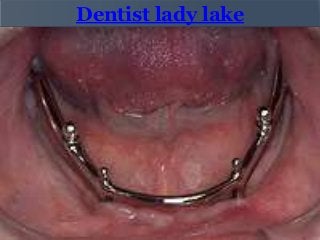 Dentist lady lake

 