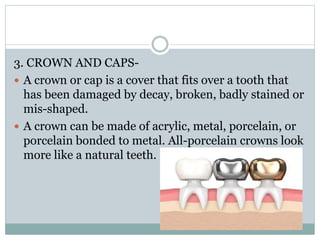 3. CROWN AND CAPS-
 A crown or cap is a cover that fits over a tooth that
has been damaged by decay, broken, badly stained or
mis-shaped.
 A crown can be made of acrylic, metal, porcelain, or
porcelain bonded to metal. All-porcelain crowns look
more like a natural teeth.
 
