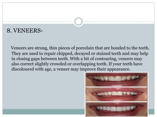 8. VENEERS-
Veneers are strong, thin pieces of porcelain that are bonded to the teeth.
They are used to repair chipped, decayed or stained teeth and may help
in closing gaps between teeth. With a bit of contouring, veneers may
also correct slightly crowded or overlapping teeth. If your teeth have
discoloured with age, a veneer may improve their appearance.
 