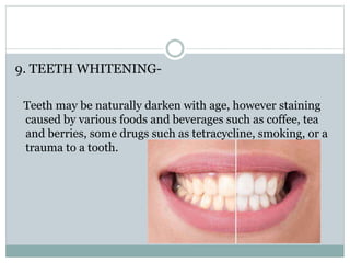 9. TEETH WHITENING-
Teeth may be naturally darken with age, however staining
caused by various foods and beverages such as coffee, tea
and berries, some drugs such as tetracycline, smoking, or a
trauma to a tooth.
 