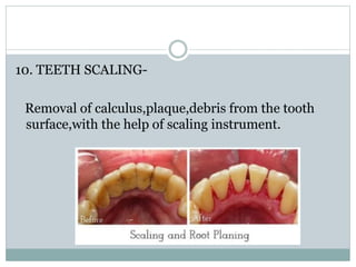 10. TEETH SCALING-
Removal of calculus,plaque,debris from the tooth
surface,with the help of scaling instrument.
 