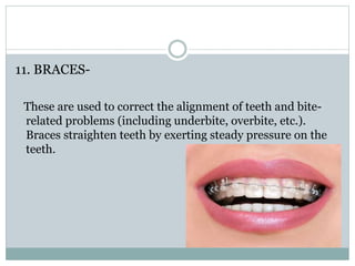 11. BRACES-
These are used to correct the alignment of teeth and bite-
related problems (including underbite, overbite, etc.).
Braces straighten teeth by exerting steady pressure on the
teeth.
 