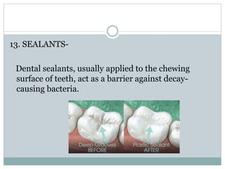 13. SEALANTS-
Dental sealants, usually applied to the chewing
surface of teeth, act as a barrier against decay-
causing bacteria.
 